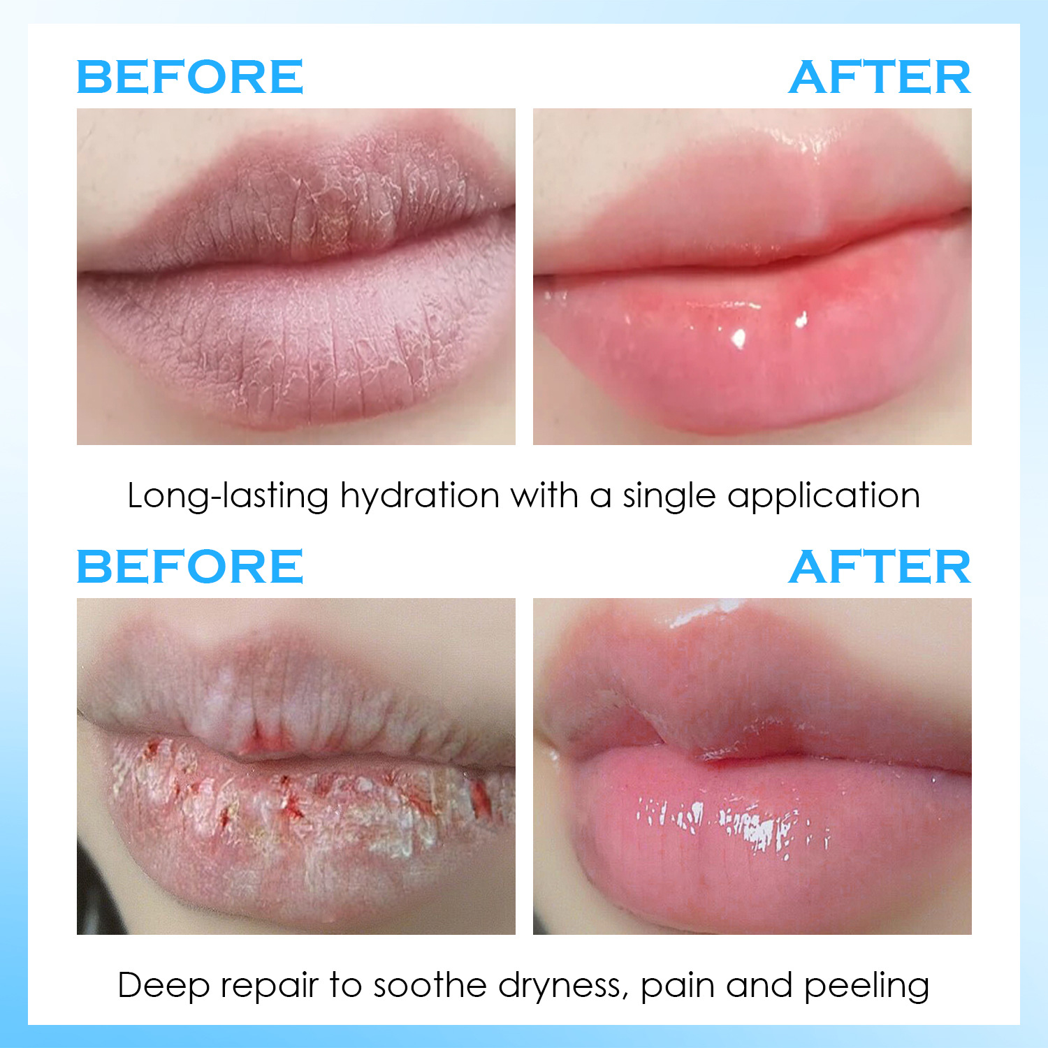 Lip Serum Moisturizing Balm Hy - Lip Balm ulasan dan harga