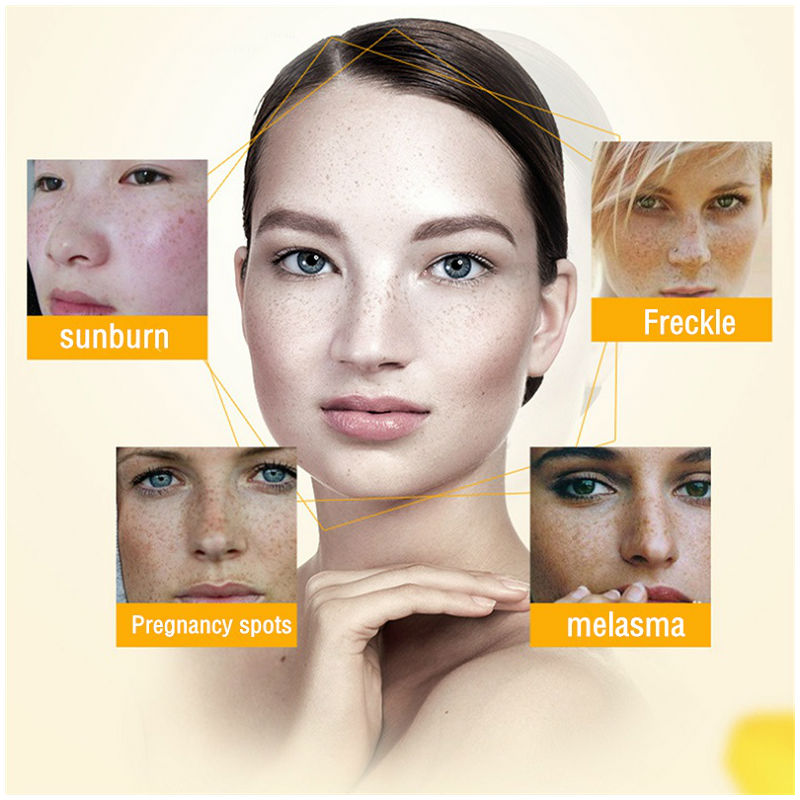 Dimollaure Whitening Freckle C - Retinol Cream ulasan dan harga