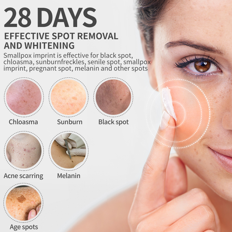 Dimollaure Whitening Freckle C - Retinol Cream ulasan dan harga