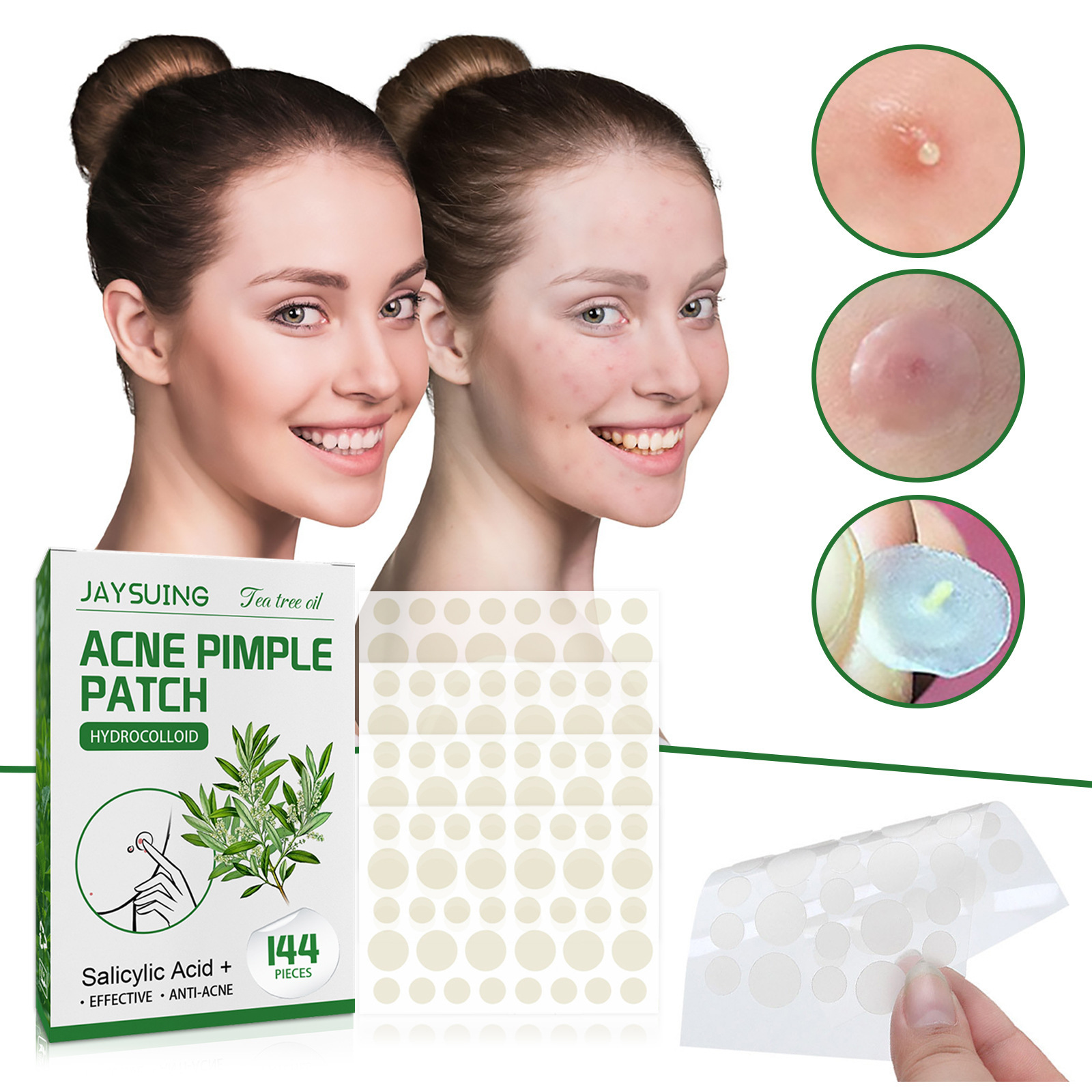 Hydrocolloid Acne Patches - Ab - Face Moisturizer ulasan dan harga