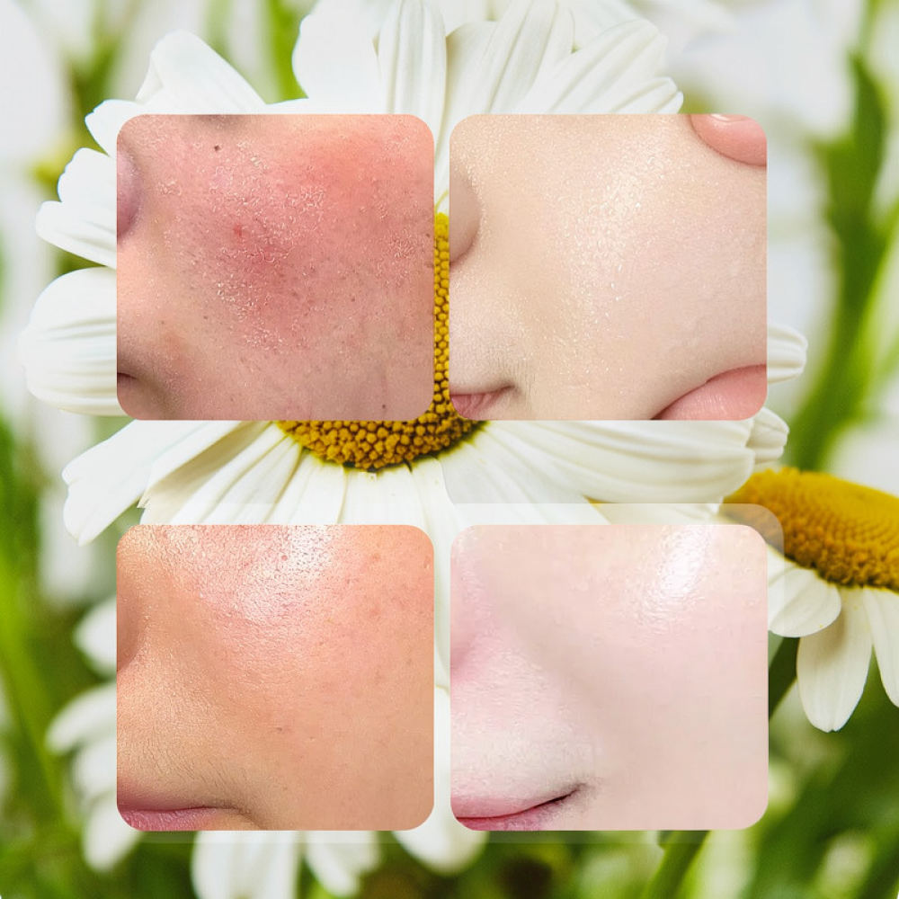 For Fykly Rose VC Chamomile B5 - Face Mask Skincare ulasan dan harga
